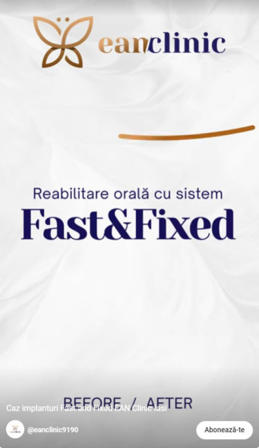 Reel Fast & Fixed EAN Clinic